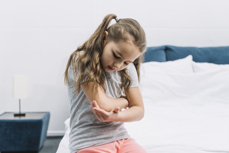 How Sleep Affects Eczema: Tips to Improve Sleep Quality