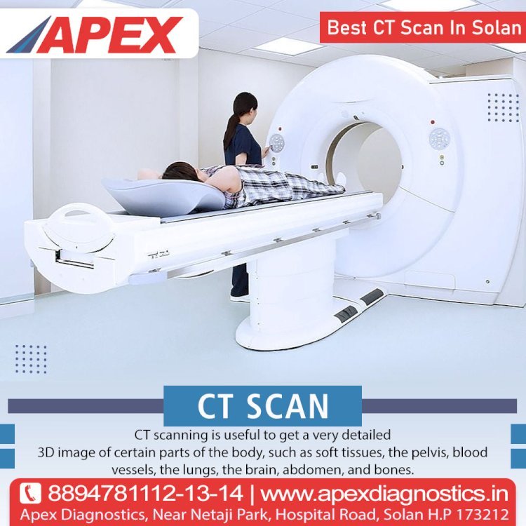 How to Choose the Right MRI Spine Services Near Solan