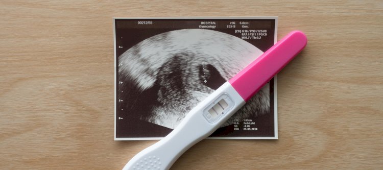 Early Pregnancy Scan: An Ultimate Guide
