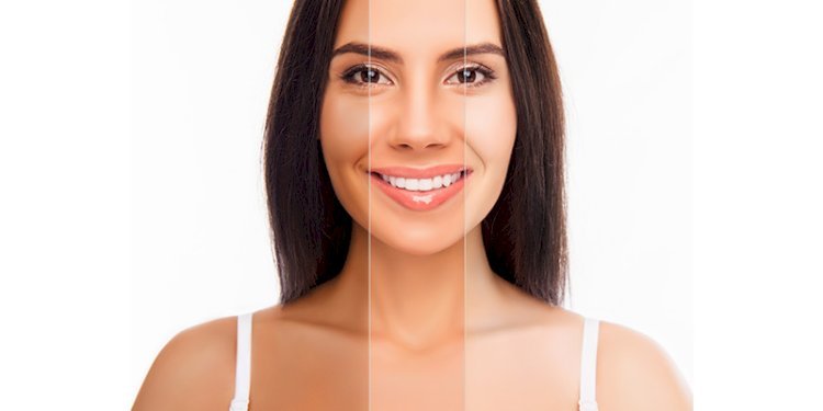Comparing Popular Whitening Brands Used in Islamabad