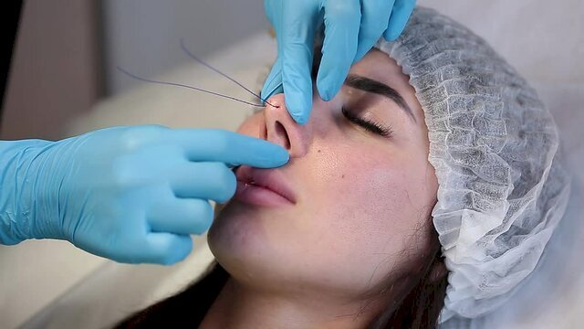 Is Non-Surgical Rhinoplasty Worth It Long-Term?