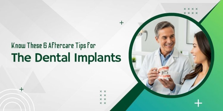 Know These 6 Aftercare Tips for the Dental Implants