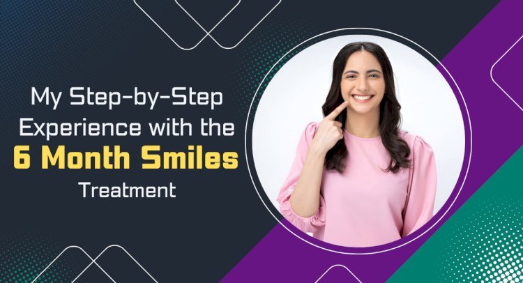 My Step-by-Step Experience with the 6 Month Smiles Treatment