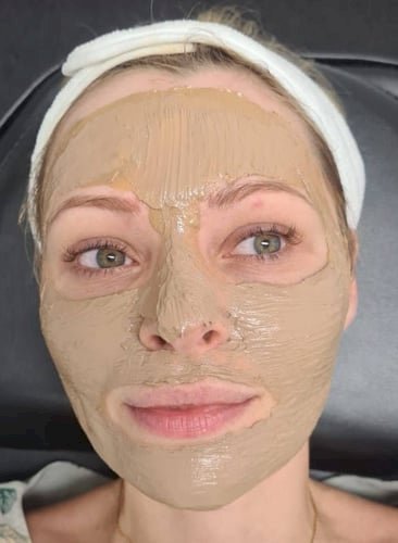What Is Cosmelan Peel and How Does It Work?