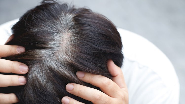 Can White Hair Be Removed on Dark Skin?