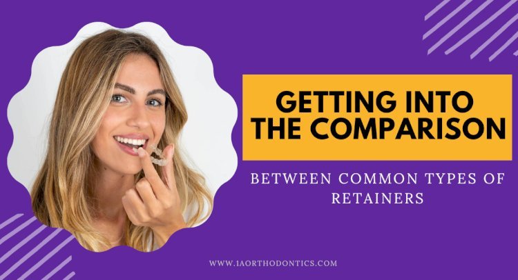 Getting into the Comparison Between Common Types of Retainers
