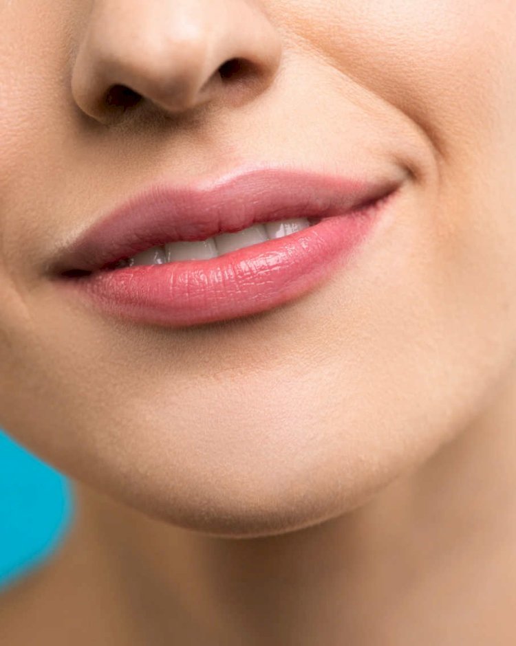 When Will I See Results After Lip Augmentation in Islamabad?