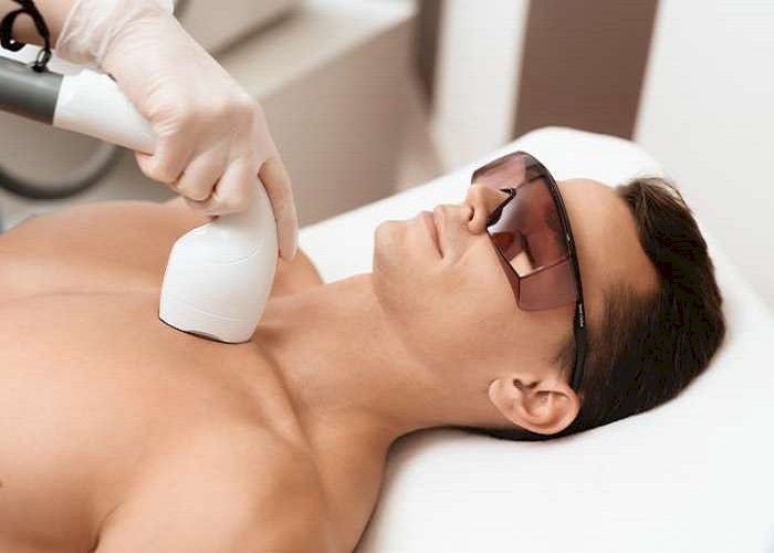 Can Men Use Laser Hair Removal Without Breaking Islamic Rules?