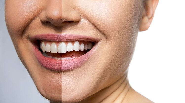 Complete Family Dental Care in Toronto: Your Smile Deserves the Best