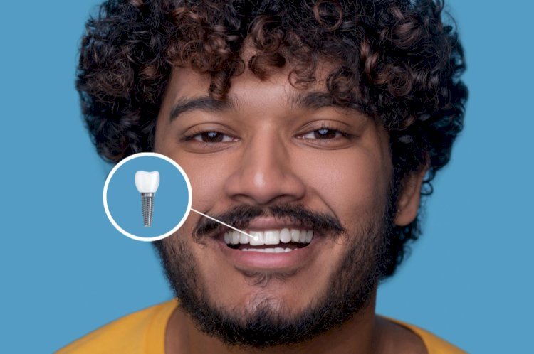Missing Teeth? Here’s Why Dental Implants Might Be Your Best Option