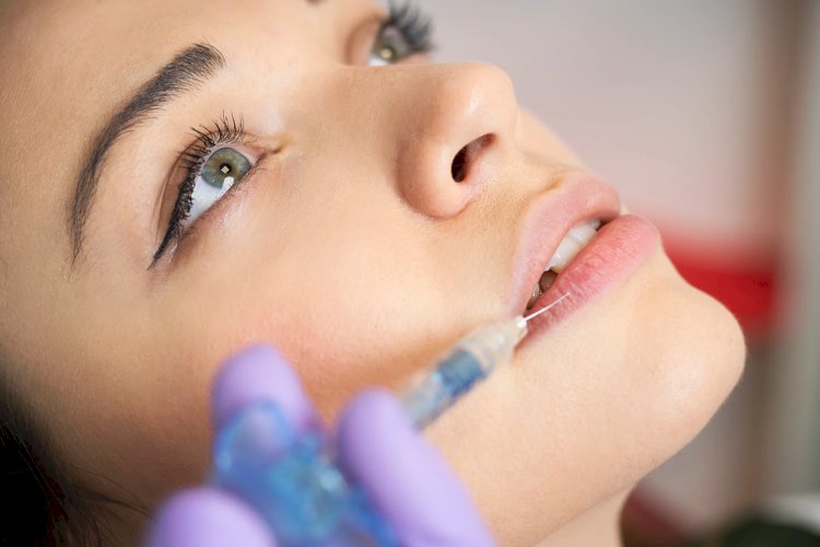 What Is Hyaluronic Acid and Why Is It Used in Lip Injections?