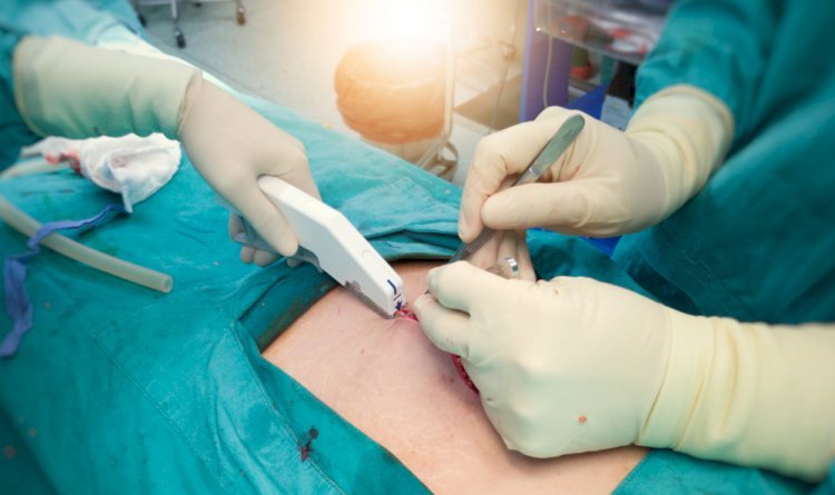 Establishing a Medical Stapler Manufacturing Plant Report 2025, Project Cost Details