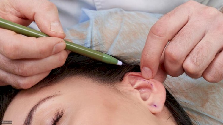 Latest Advancements in Ear Reshaping in Islamabad