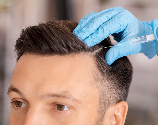 Hidden Costs to Ask About Before Booking a Hair Transplant