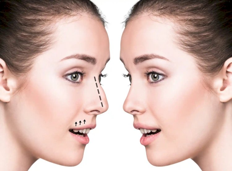 Best Rhinoplasty Surgeons in Dubai: Clinical Judgment Counts