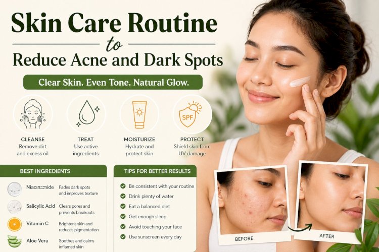 Skin Care Routine to Reduce Acne and Dark Spots