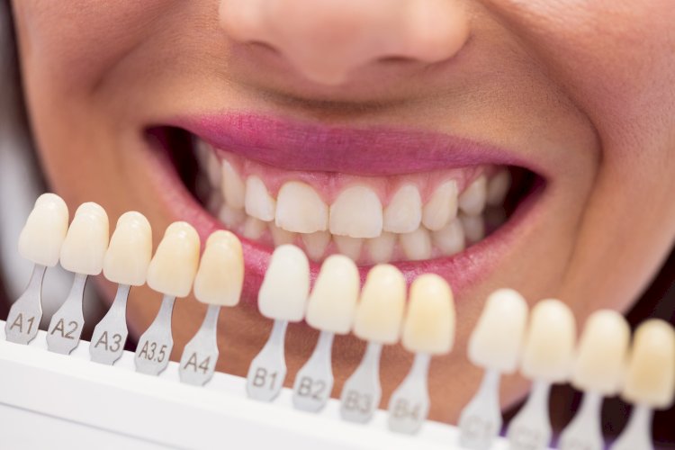 7 Signs You May Need a Crown Tooth Instead of Another Filling